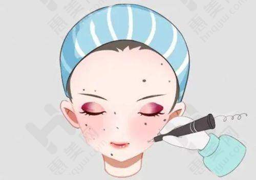 吸脂成效令人满意