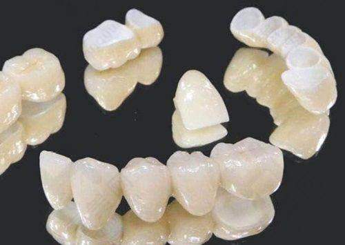 牙齿矫正项目优势