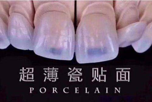 北京名一口腔门诊部的综合推测