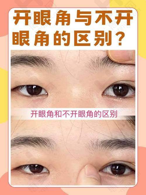 邓哲：苏大附二院的高能整形医生