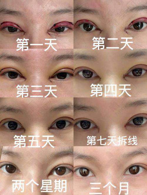 唐婷的技术优势显著