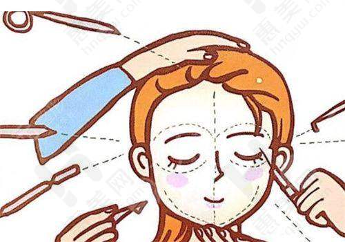 注射部位和范围影响价格