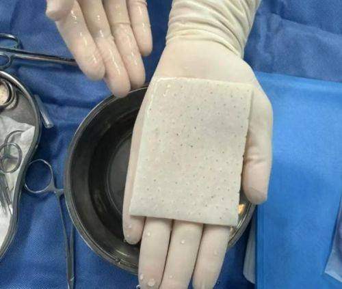 术前沟通与风险评估不可少