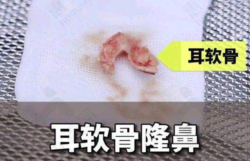 哈尔滨双燕医美——综合治疗黄褐斑的优质之选