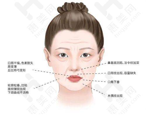 哈尔滨艺星整形医院——祛斑优势显著的皮肤激光医院