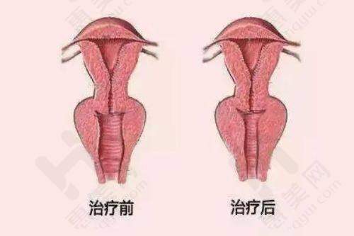 哈尔滨激光美肤祛斑部分医院排行榜相关亮点