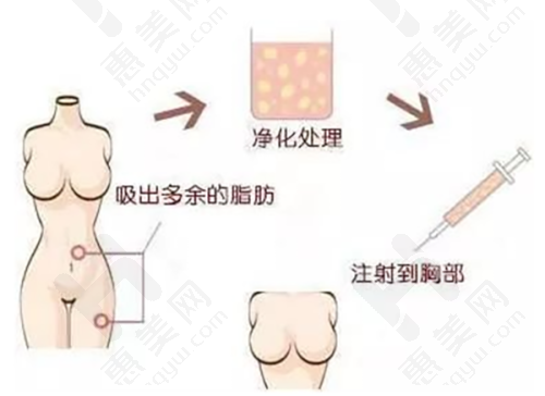 超皮秒祛斑价格