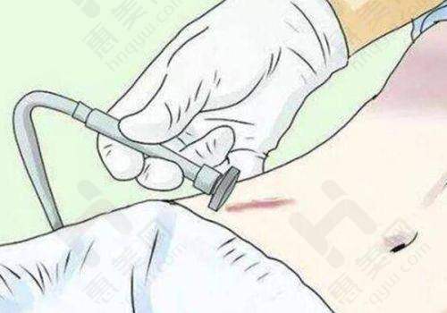 选择医院的建议