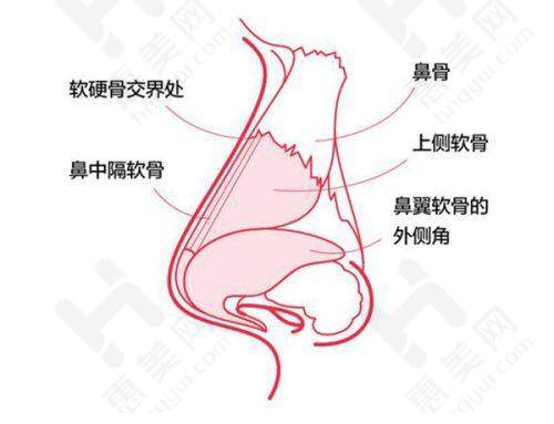 不同斑点类型的激光祛斑价格
