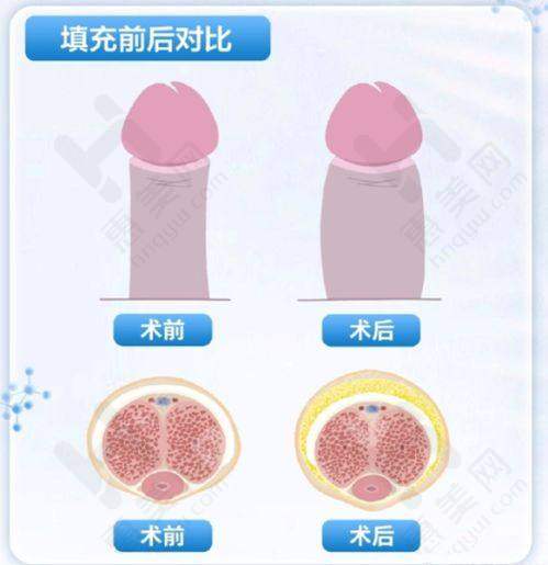 北京丁博士医疗美容诊所保护手术安心无忧