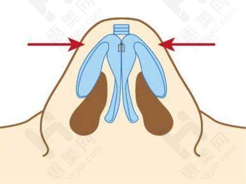 广州华美医疗美容医院荣誉满满