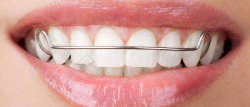 盐城雅洁口腔门诊部收费合理透明