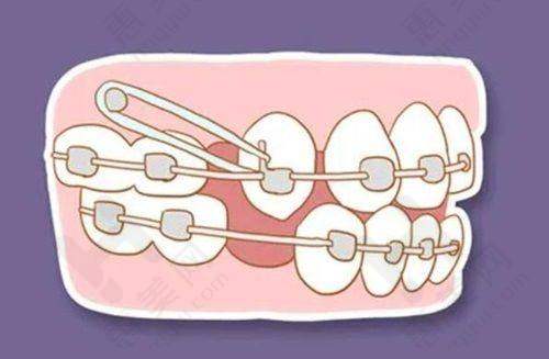 盐城倍美口腔门诊部（金鹰店）优惠预约便利