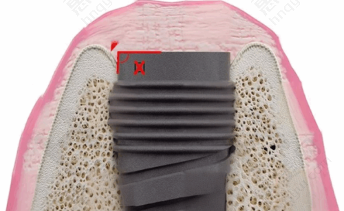 宜春佳美口腔门诊部设备技术好