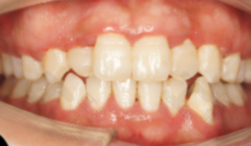 盐城雅洁口腔门诊部提供良好环境与优质服务