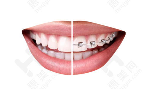 盐城雅洁口腔门诊部配备精良设备与技术