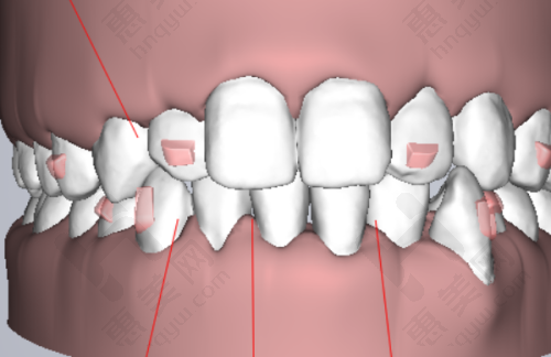 盐城倍美口腔门诊部（金鹰店）医生团队专精