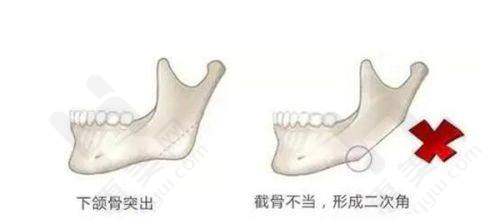 广州华美医疗美容医院活动与技术发布不断