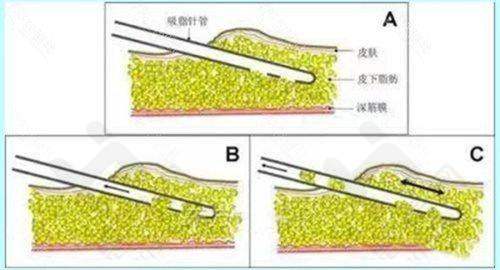 广州番禺阳光整形美容医院医生团队专精