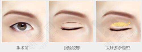 成都韩艺医学美容门诊部特色项目丰富