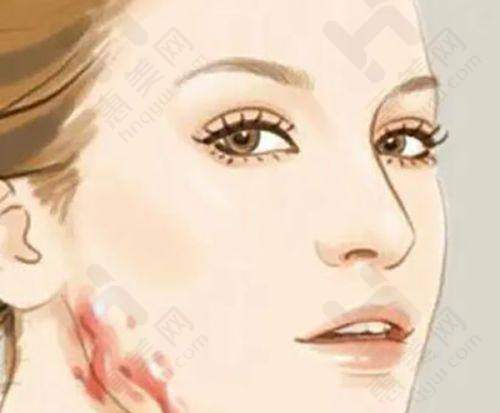 成都雍和华仁医疗美容门诊部交通便利且收费合理