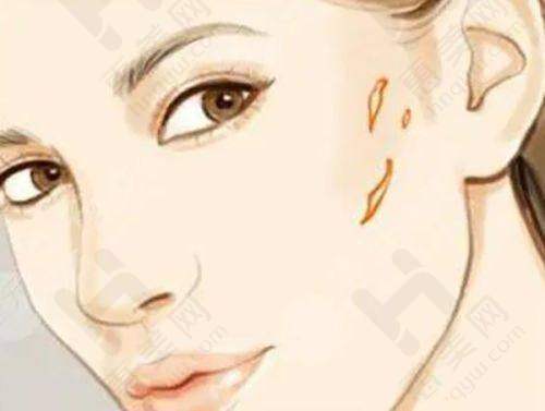 广州华美医疗美容医院特色项目丰富