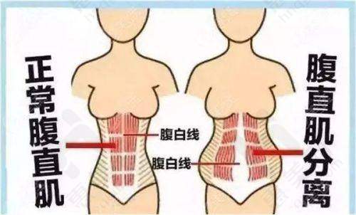 福州隆美尔整形美容医院提供丰富整形项目