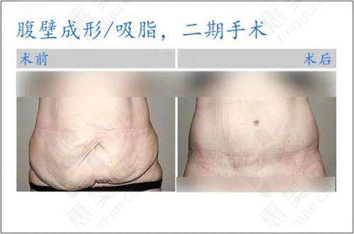 广州艾美医疗美容门诊部设有丰富特色中 心