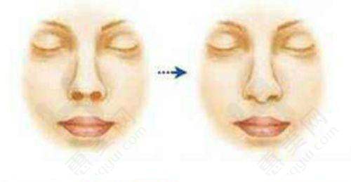 北京丁博士医疗美容诊所提供多样预约方式