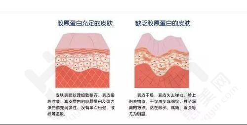 天津欧华威莎医疗美容诊所具备人中缩短技术优势