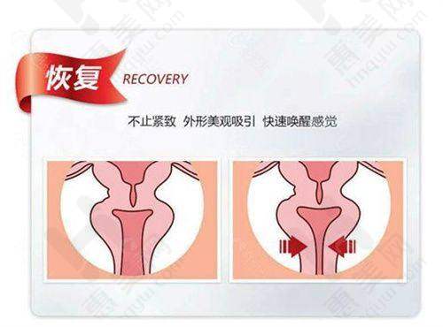 上海美之仁医疗美容医院提供多样特色项目