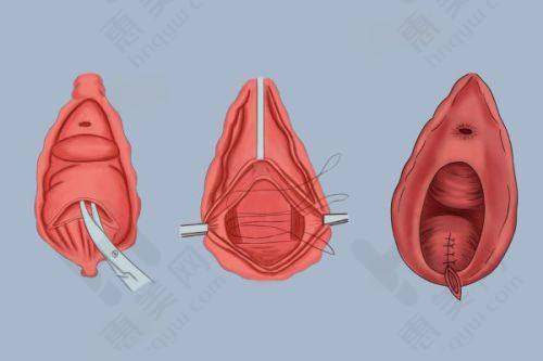 洛阳亚峰整形美容诊所收获良好患者口碑