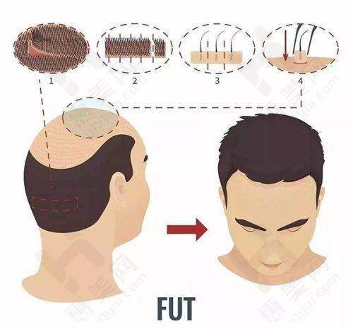 上海南山医院美容外科具备特色整形项目
