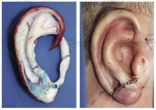 兰州华美整形美容医院设备精良齐全