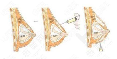天津维美医疗美容医院价格体系合理