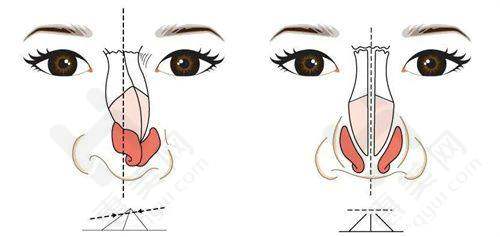 兰州华美整形美容医院医生团队实力雄厚