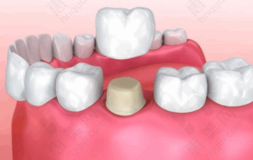 通辽红会口腔门诊部服务特色贴心周到
