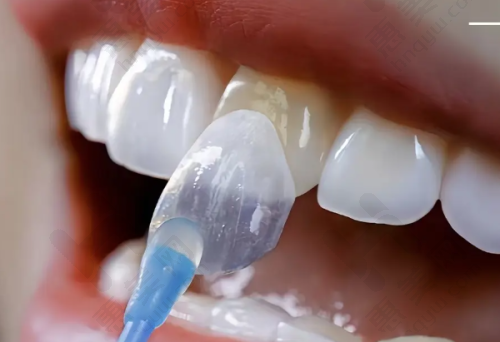 邵阳雅贝康口腔门诊部(中 心路机构)口碑良好