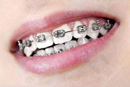 韶关怡美口腔诊所诊疗项目齐全