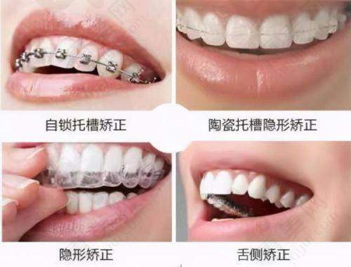 通辽红会口腔门诊部医生团队专精可靠