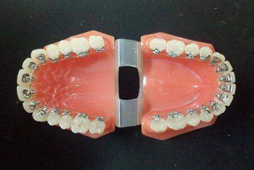 韶关怡美口腔诊所正畸优势明显