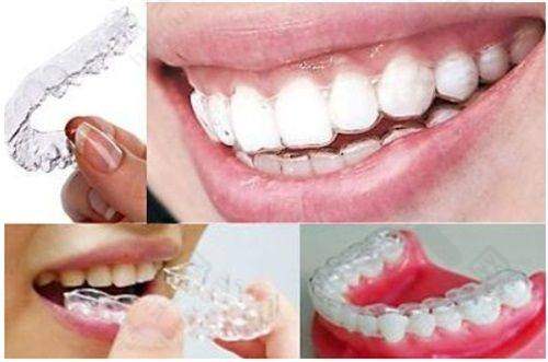 邢台张绍然口腔诊所注重技术交流