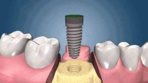 唐山牙博士口腔门诊部(丰润店)的价格体系