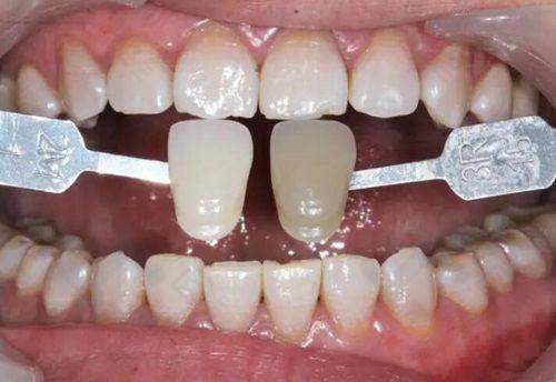 韶关牙博仕口腔门诊部提供多样化的服务与良好的口碑