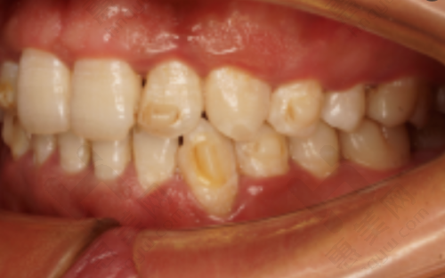 邢台张绍然口腔诊所提供多样服务项目