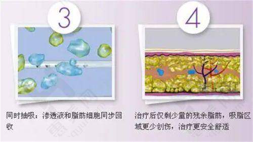 上海美之仁医疗美容医院