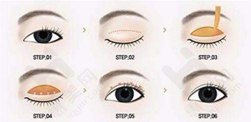 洛阳亚峰整形美容诊所拥有强大医生团队