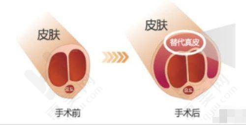 北京伊美尔长岛医学美容门诊部的科研成果