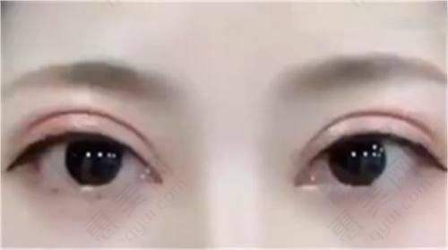 郑州张伶伶医学整形研究所设备设施精良