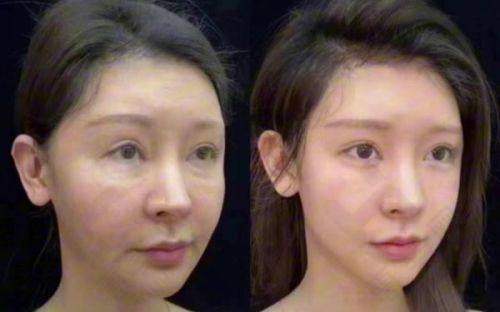 长沙叶子整形美容医院价格透明优惠多多